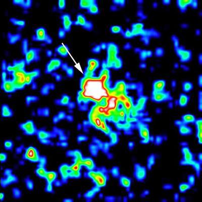 Gamma-Ray Bursts Common To Normal Galaxies? Hubble Data Offer New Clues and Puzzles