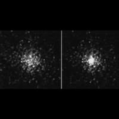 The Hubble Reveals the Evolving Core of a Dense Star Cluster
