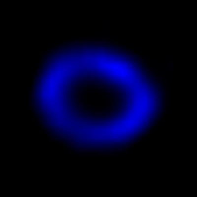 A Chandra View of Supernova 1987A