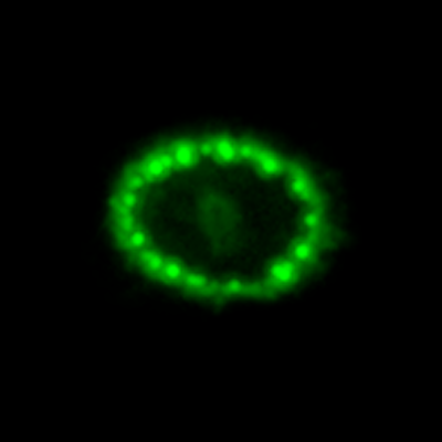 A Hubble View of Supernova 1987A