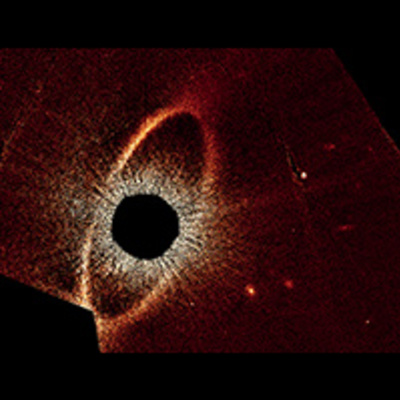 Fomalhaut  System